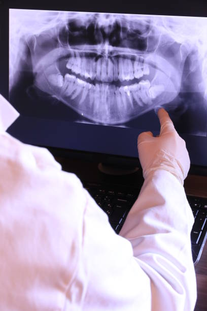 Best Knocked-Out Tooth (Avulsed Tooth) Treatment in Saco, ME