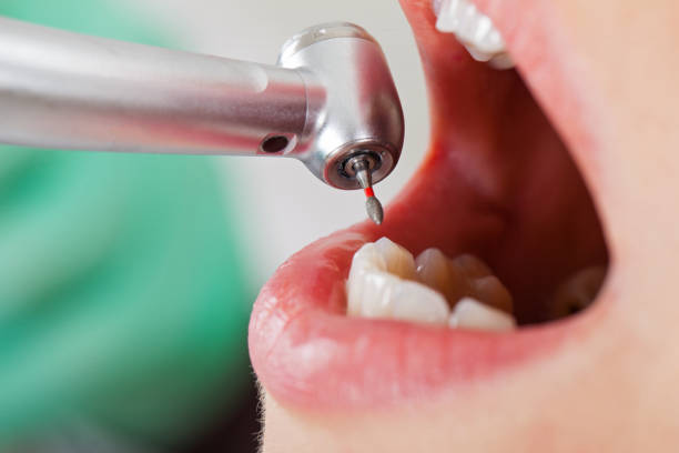 Best Dental Abscess Treatment in Saco, ME